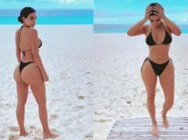 Conoce los riesgos de la cirugía conocida como BBL, que se realiza para tener un cuerpo como el de Kim Kardashian