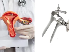 Descubre el innovador examen ginecológico que podría sustituir al Papanicolaou en casa.