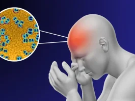 Meningitis: síntomas