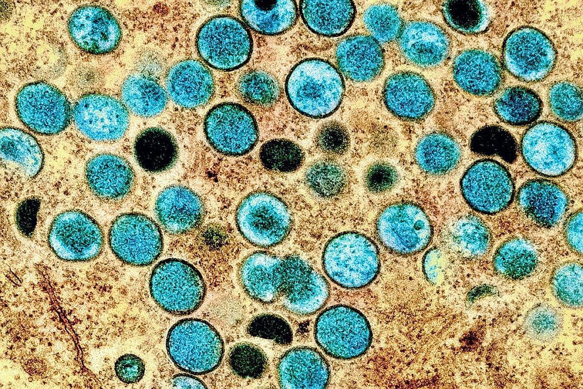 Explorando los riesgos y desafíos de la emergencia sanitaria por la viruela del mono.