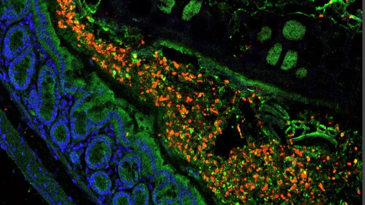 Hongo aliado: una solución natural contra infecciones fúngicas mortales.