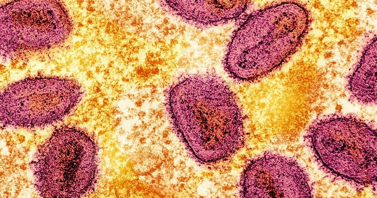 Viruela del mono: nueva cepa contagiosa y sus riesgos para una posible pandemia.