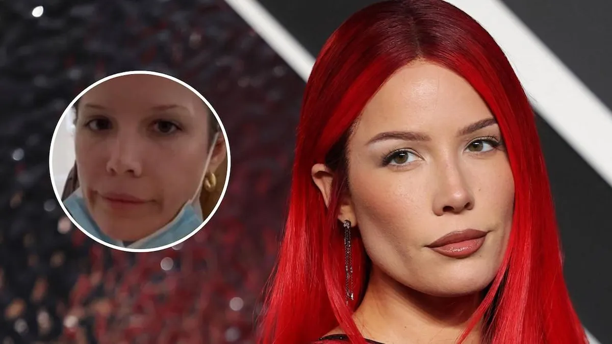 Halsey hospitalizada tras sufrir una convulsión