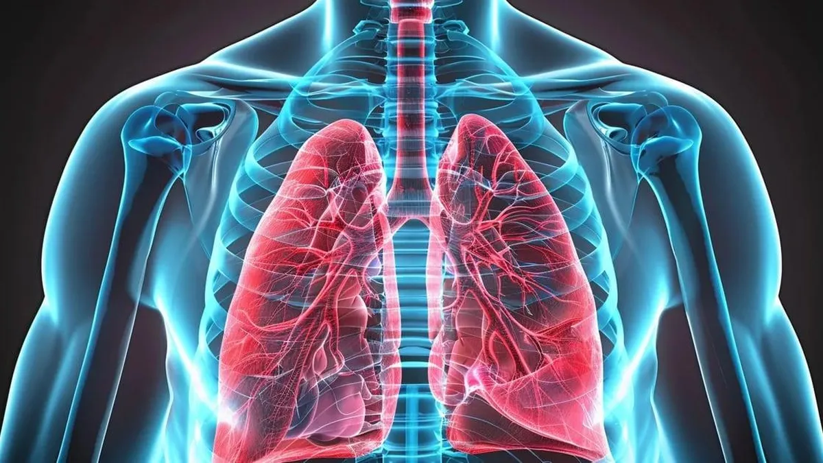 Diagnóstico temprano de fibrosis pulmonar idiopática: clave para un tratamiento eficaz.