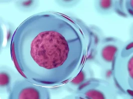 Una mujer recupera la producción de insulina tras un innovador tratamiento con células madre.