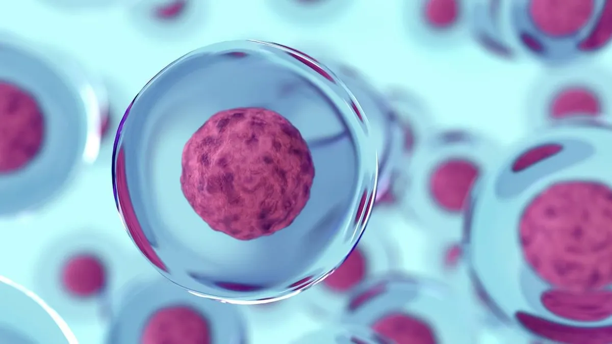 Una mujer recupera la producción de insulina tras un innovador tratamiento con células madre.