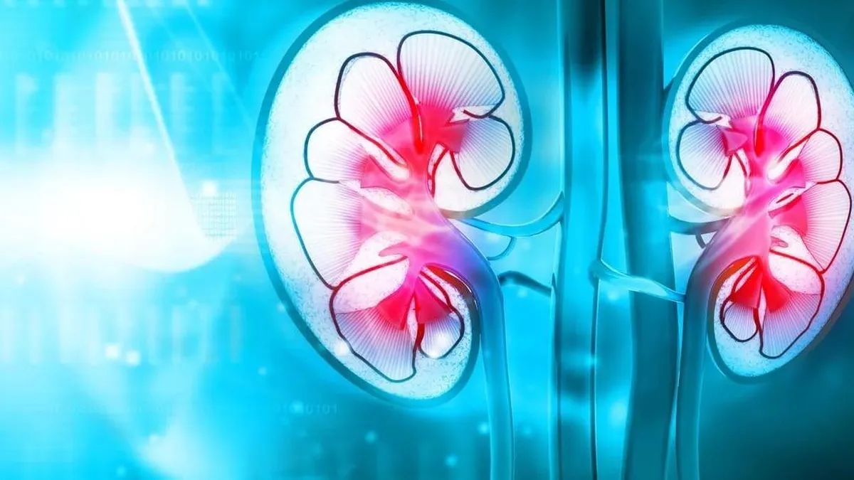 Explorando el diagnóstico de demencia en pacientes con insuficiencia renal aguda.