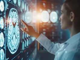 Descubre las diferencias entre Alzheimer y demencia: guía de expertos para identificarlas.