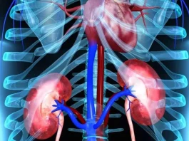 El tratamiento combinado mejora significativamente la supervivencia en cáncer de riñón avanzado.