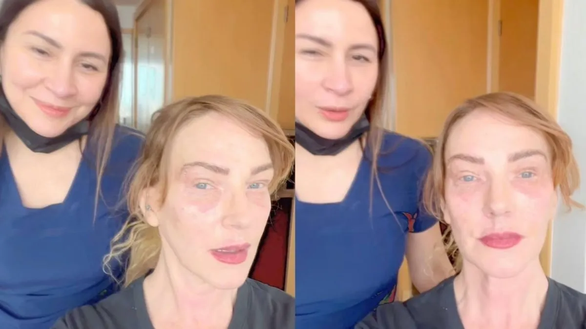 Catalina Pulido revela su transformación estética antes de "Palabra de Honor".