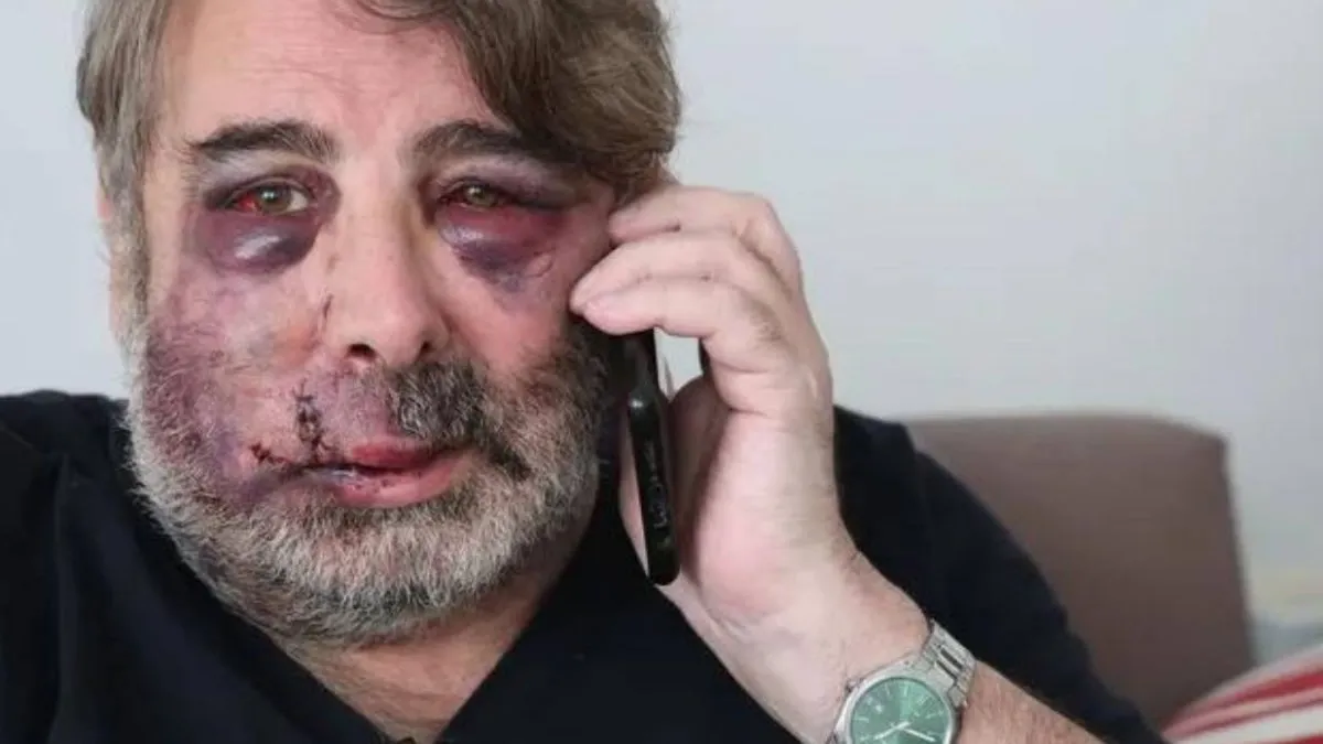 Hombre agredido tras pedir a jóvenes que bajaran la música: quedó desfigurado.