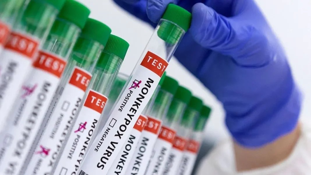 Protocolo activado en Tome ante un posible caso de viruela del mono.