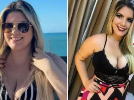 Tragedia en Brasil: empresaria fallece tras múltiples cirugías estéticas en un día.