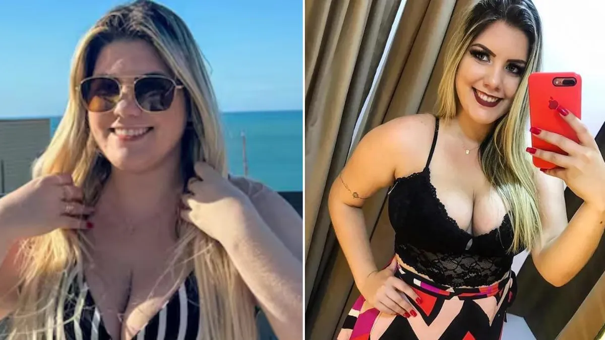 Tragedia en Brasil: empresaria fallece tras múltiples cirugías estéticas en un día. Tragedia en Brasil: empresaria fallece tras múltiples cirugías estéticas en un día.