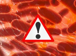 Productos en Chile con riesgo de Listeria: ¿quiénes están en peligro mortal?