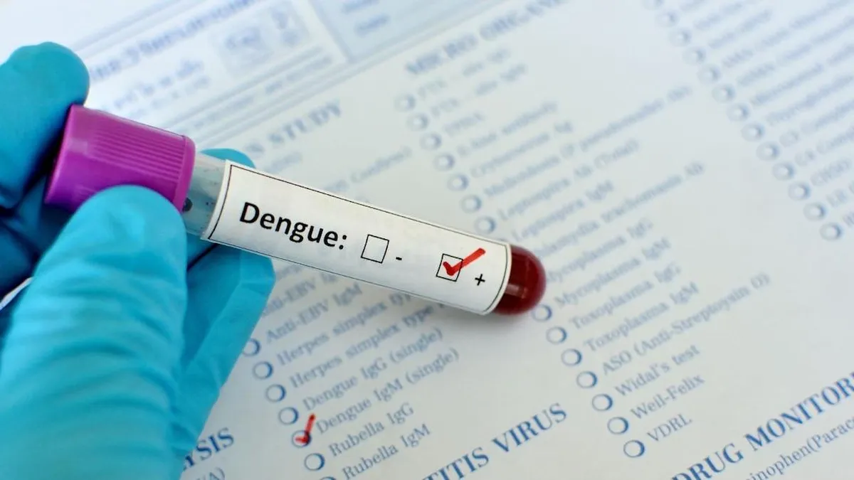 La ANMAT aprueba el primer test de antígeno nacional para detectar dengue.