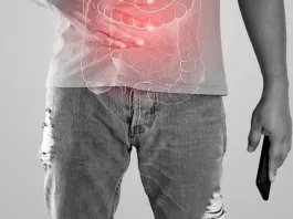 El alto costo financiero de la enfermedad de Crohn y colitis en pacientes.