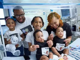 Gemelos siameses logran separarse tras una compleja cirugía de 8 horas.