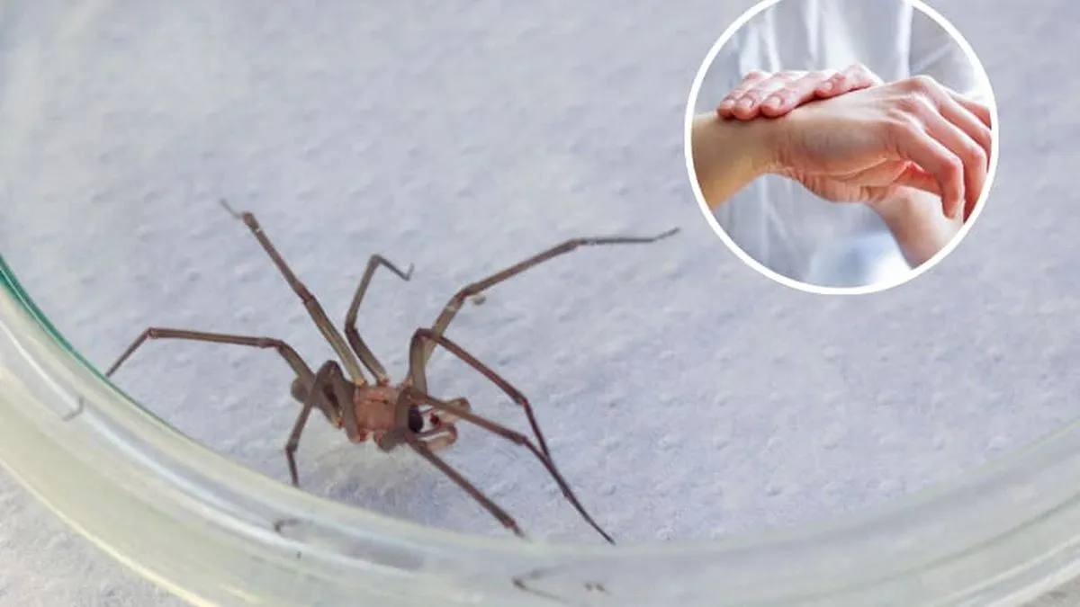 Consejos esenciales tras una mordedura de araña de rincón en Chile.