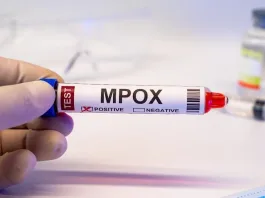 Estudio revela quiénes son más propensos a vacunarse contra la viruela símica.