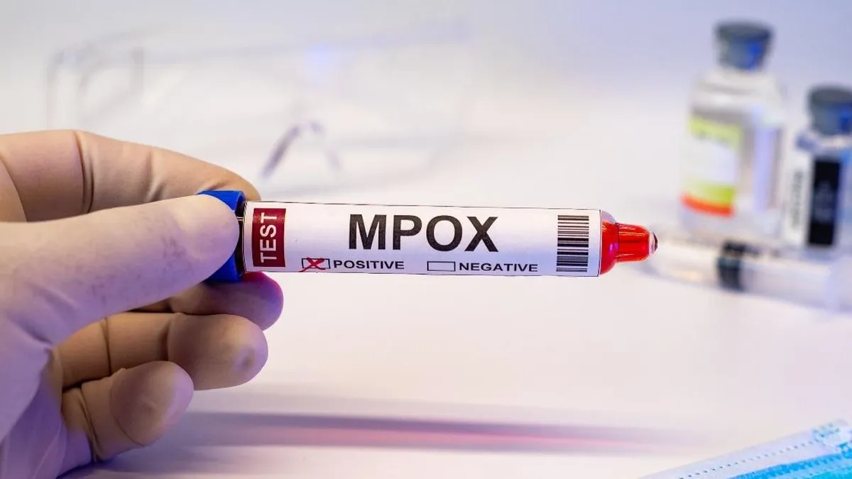 Estudio revela quiénes son más propensos a vacunarse contra la viruela símica.