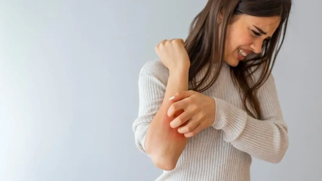 La terapia de conversación