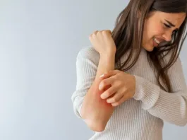 La terapia de conversación