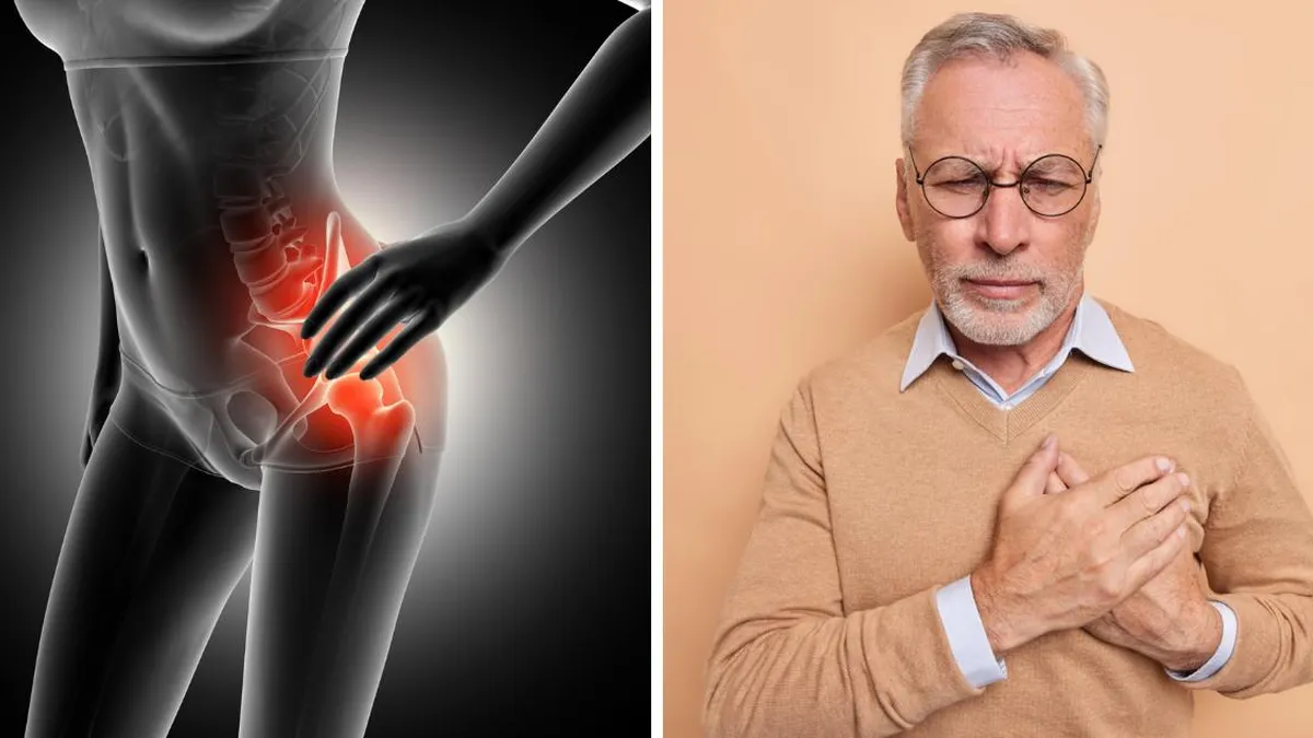 Estudio revela que fractura de cadera aumenta riesgo de enfermedades cardiovasculares.