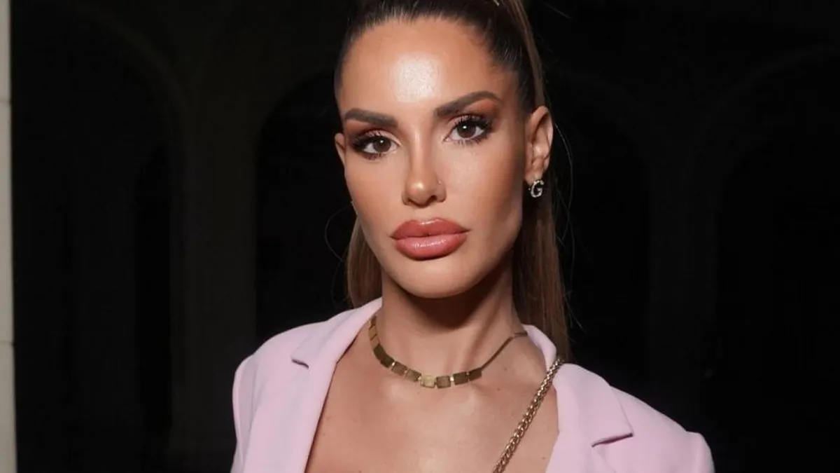 Gala Caldirola revela el motivo detrás de su retoque labial en una reciente entrevista.