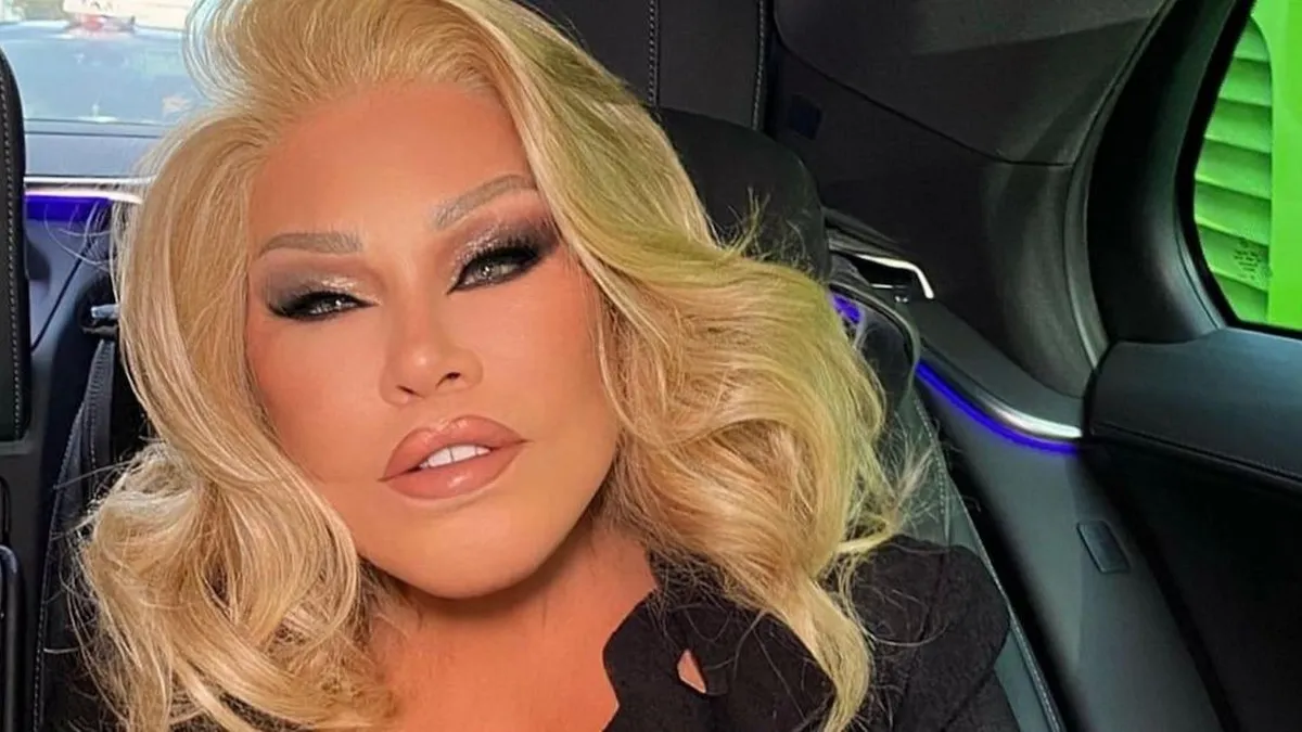 La sorprendente historia de Jocelyn Wildenstein: riqueza y caída en la quiebra.