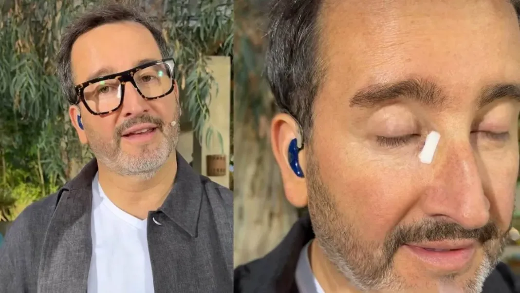 Eduardo Fuentes sorprende con un parche en el ojo en su regreso al 