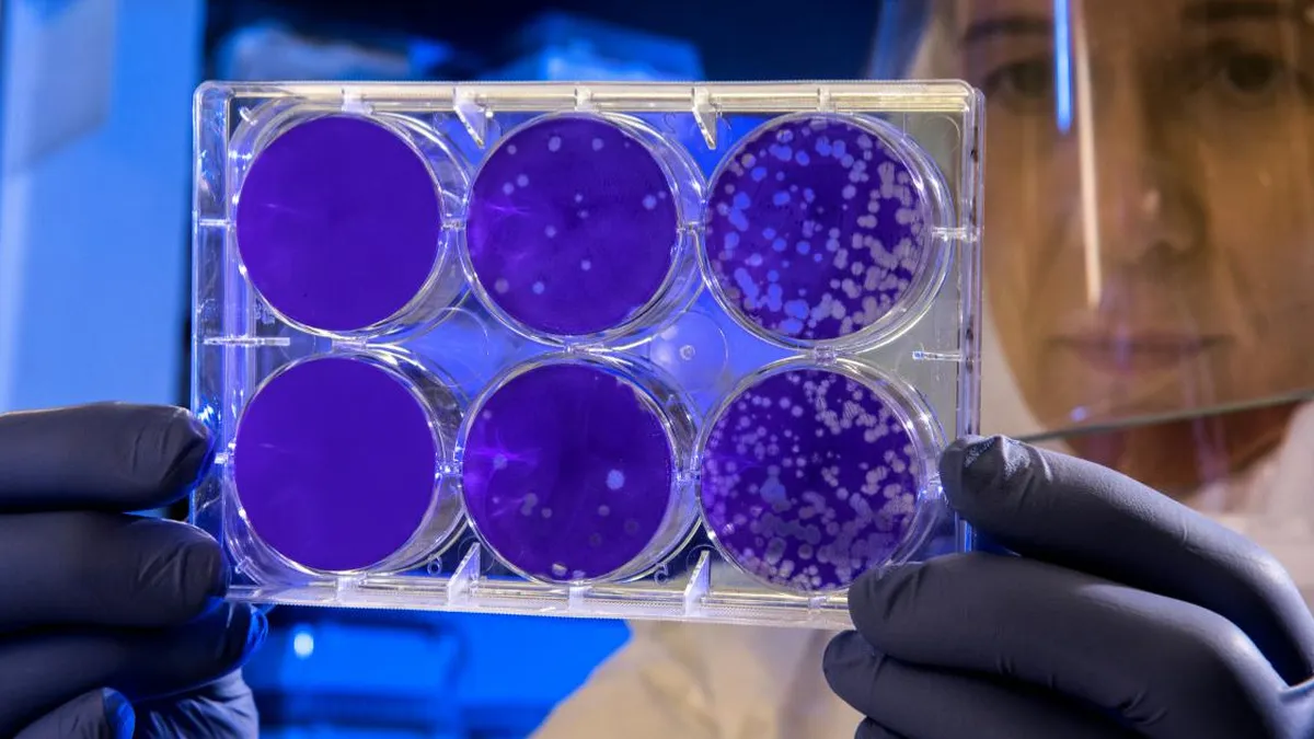 Una IA desentraña el misterio de las superbacterias en solo 2 días.