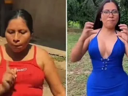 La mujer del viral "Son de amores" sorprende con su nueva imagen tras cirugía.