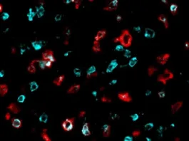 Nuevo marcador celular: clave para predecir respuesta a inmunoterapia en cáncer.