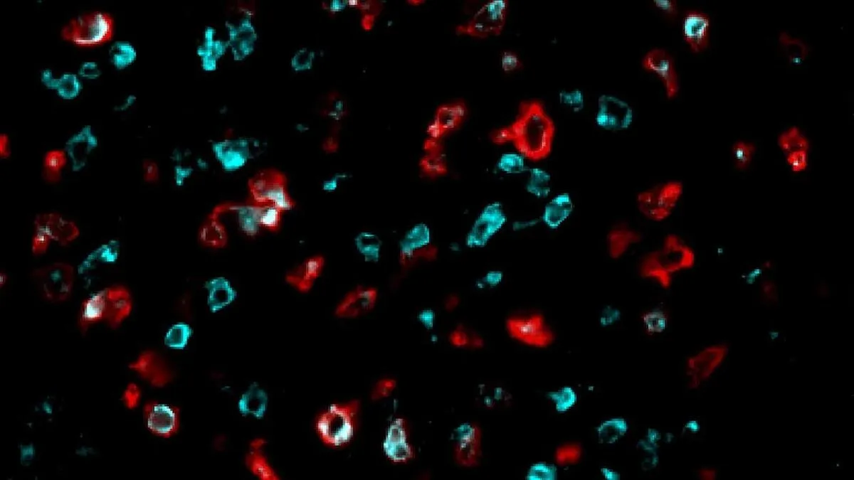 Nuevo marcador celular: clave para predecir respuesta a inmunoterapia en cáncer.