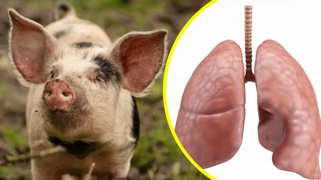 Primer trasplante de pulmón de cerdo a humano con muerte cerebral en la historia.