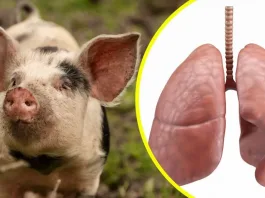 Primer trasplante de pulmón de cerdo a humano con muerte cerebral en la historia.