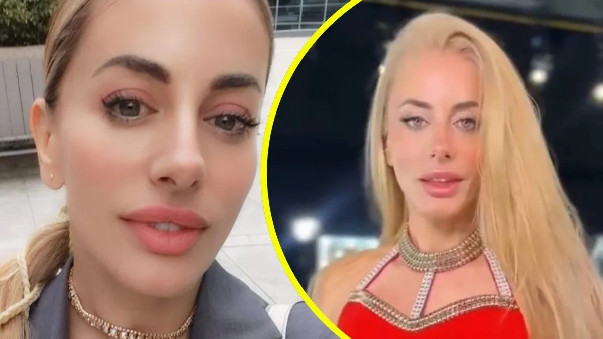 Catalina Palacios enfrenta críticas por su nuevo retoque estético: 'Jamás pararé'.