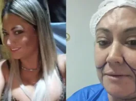 Denisse Campos se transforma con 6 cirugías estéticas para su regreso al reality.