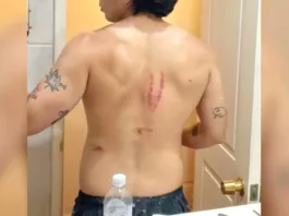 El cantante urbano se lesiona gravemente en la espalda tras una caída en Navidad.