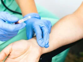 Un examen innovador que podría predecir el riesgo de muerte a 5 o 10 años.