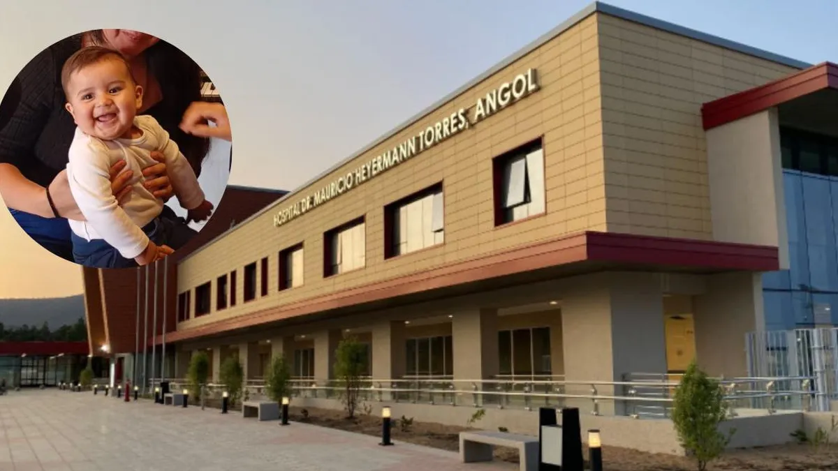 Bebé en riesgo: urgencia por cirugía cráneo y críticas al Hospital de Angol.