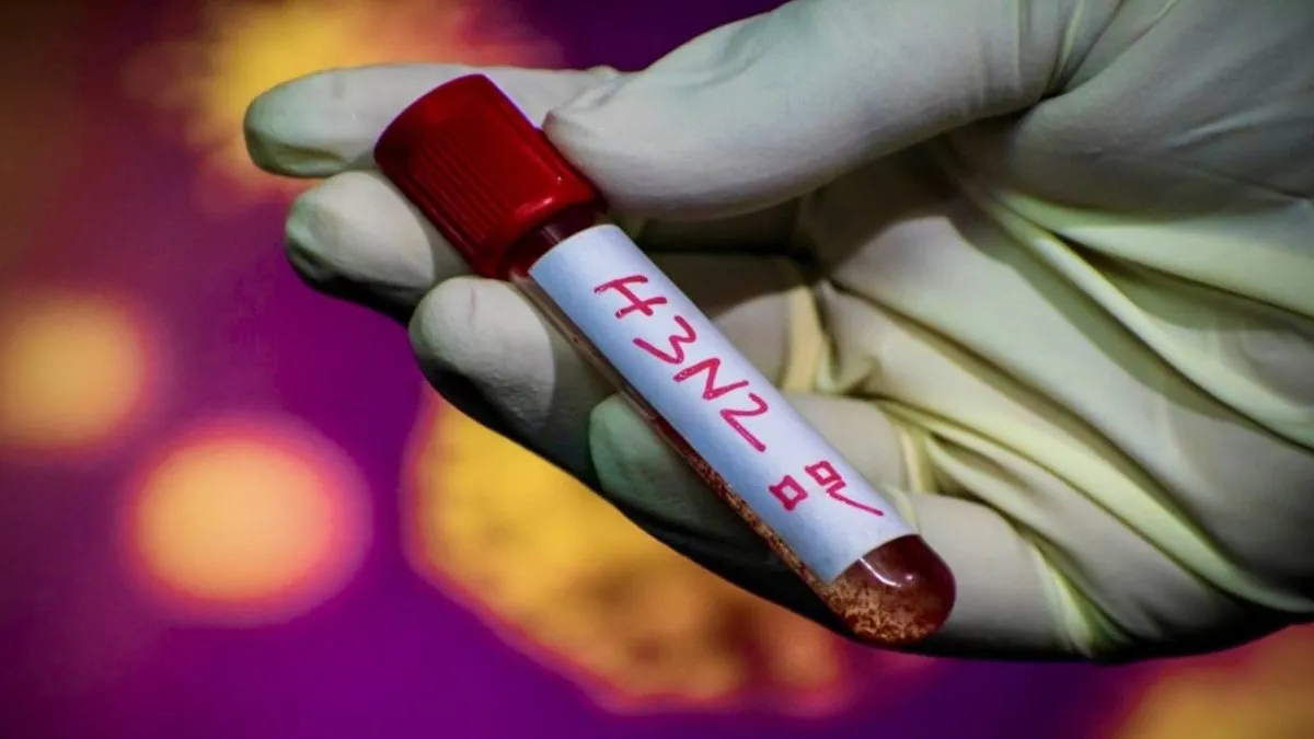 Chile se alista ante la amenaza de la súpergripe H3N2: ¿Estamos listos para enfrentarla?