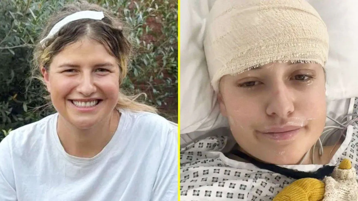 Alice Chawner enfrenta un tumor cerebral tras un accidente en la universidad.
